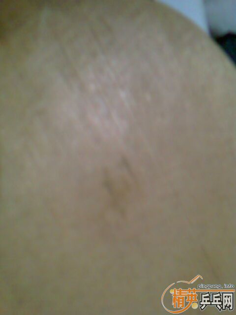 ����ɽ�Ƥ�Ͱ��Ӽ��۴����������ϼ۸�Ͳ���ͼ��