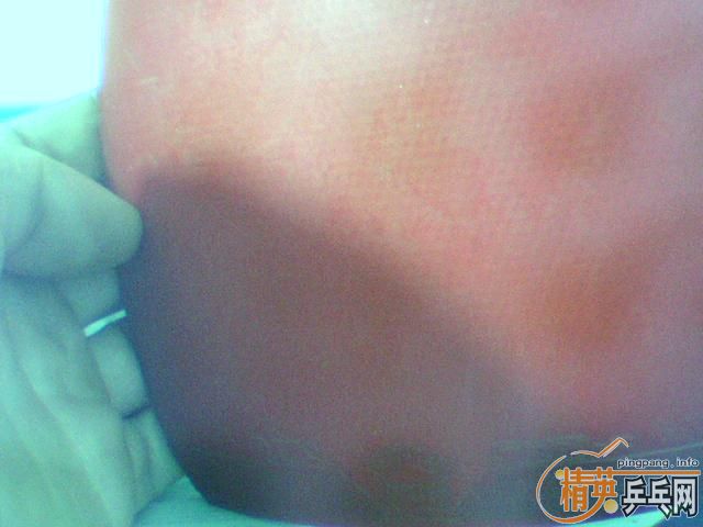 ��ֱ������ϲ���������һЩ�����׽�