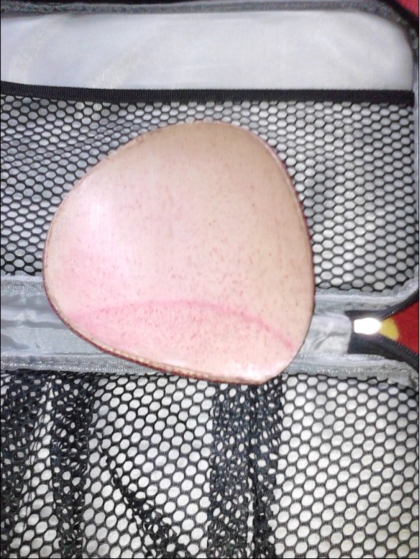 ��CL-CR ���׽�