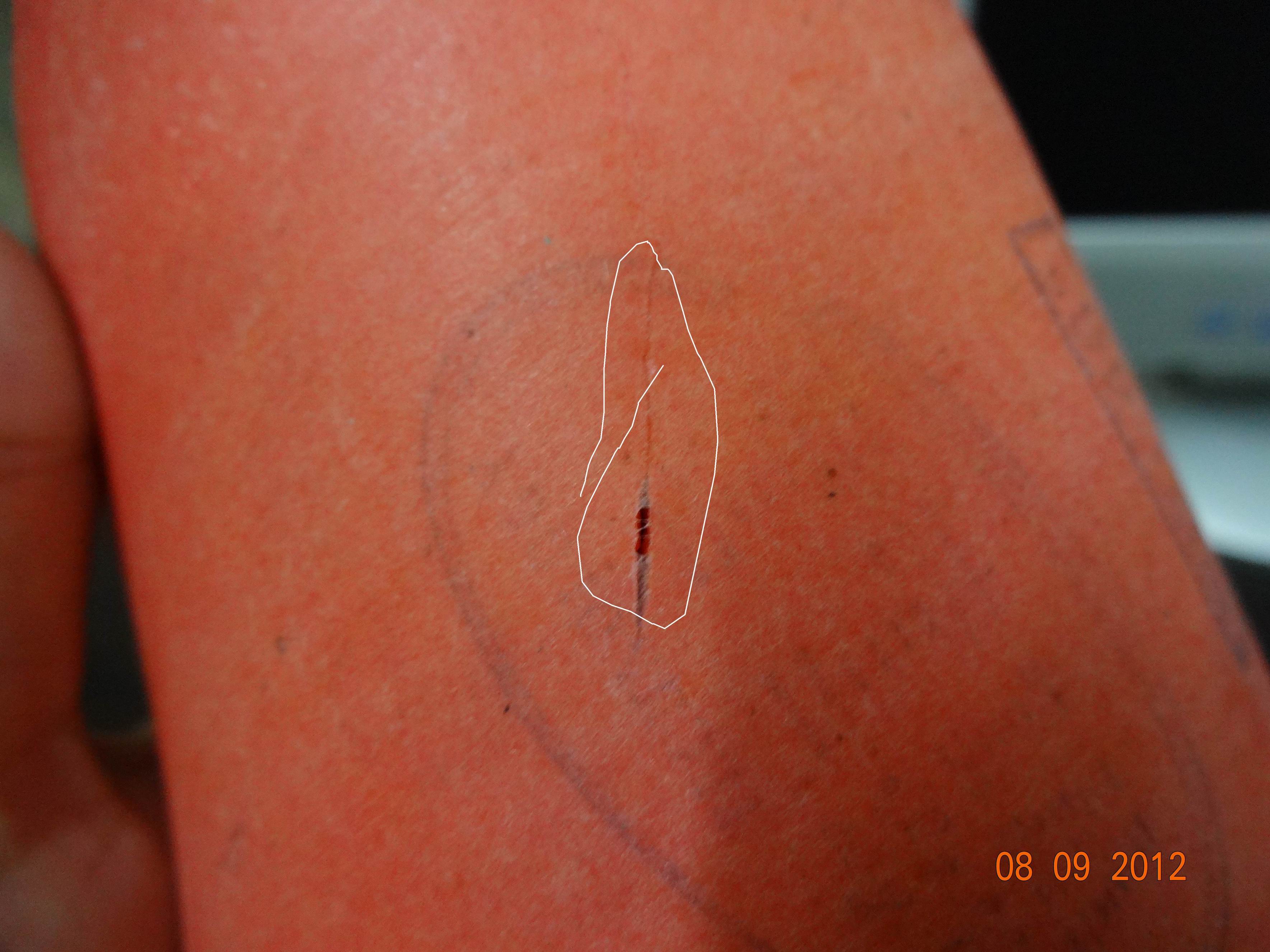 ��Щ����Ʒ��Ľ�Ƥ