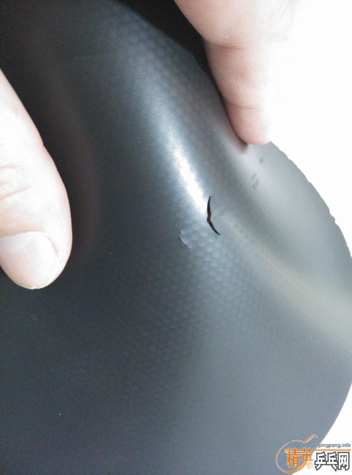 st��Rutis����270���ʷ�Ѫ���ˣ�