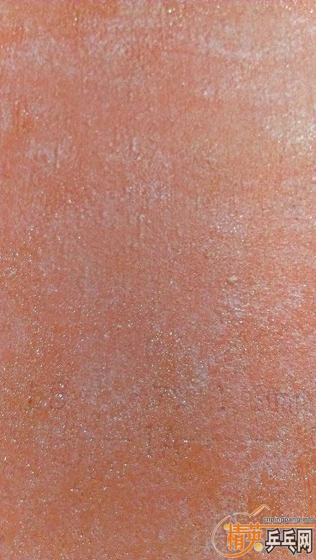 ˦��05���������������켫��