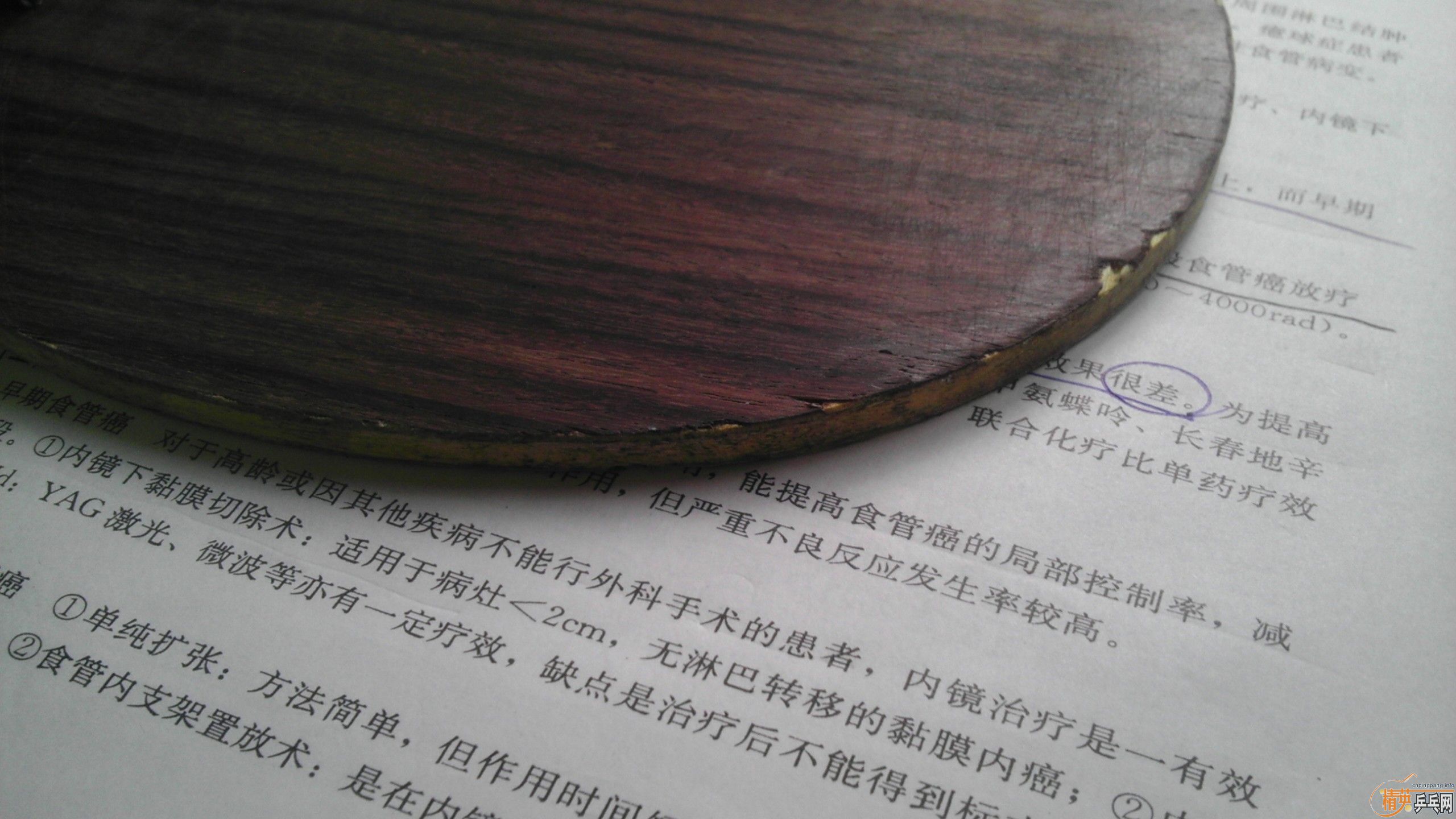 ľ飬ye˹ٿ õ xo